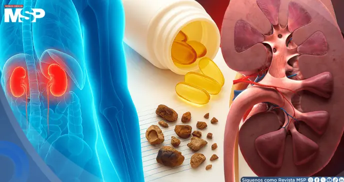 ¿Estás consumiendo demasiada vitamina D?  Esto es lo que debes saber sobre sus efectos en los riñones