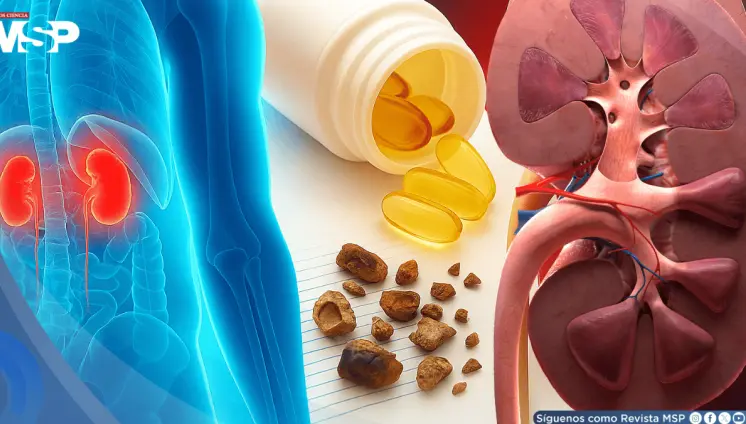 ¿Estás consumiendo demasiada vitamina D?  Esto es lo que debes saber sobre sus efectos en los riñones