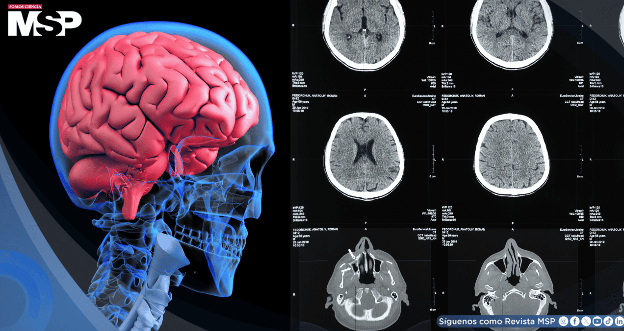 Identifican biomarcador que predice respuesta a tratamientos antipsicóticos en esquizofrenia