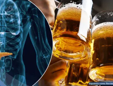 Estudio revela posible vínculo entre el consumo de alcohol y el aumento del riesgo de cáncer de páncreas