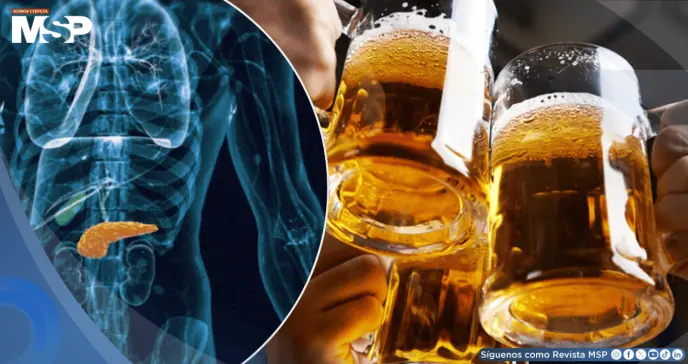 Estudio revela posible vínculo entre el consumo de alcohol y el aumento del riesgo de cáncer de páncreas