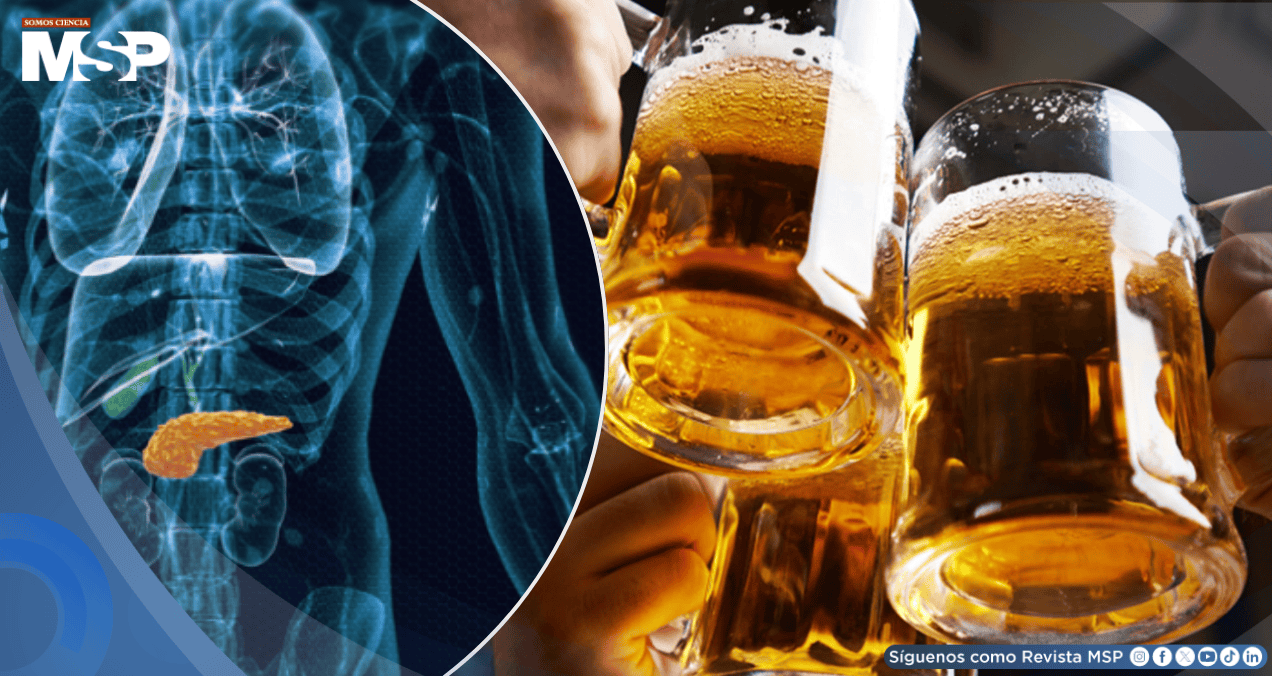 Estudio revela posible vínculo entre el consumo de alcohol y el aumento del riesgo de cáncer de páncreas