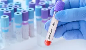 Alzhéimer: un compuesto de litio restaura la memoria en ratones dando esperanza a la ciencia