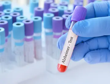 Alzhéimer: un compuesto de litio restaura la memoria en ratones dando esperanza a la ciencia