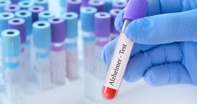 Alzhéimer: un compuesto de litio restaura la memoria en ratones dando esperanza a la ciencia