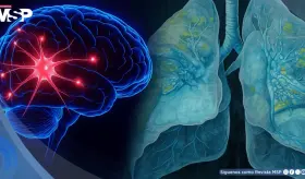 La hipoxia de forma controlada podría frenar el daño celular en el párkinson, según estudio 