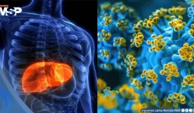OMS clasifica la hepatitis D como cancerígena: Esto es lo que debe saber sobre su transmisión