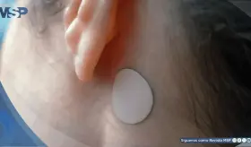 FDA alerta sobre riesgos graves de hipertermia por uso del parche antináuseas Transderm Scop