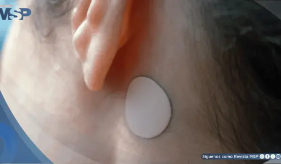 FDA alerta sobre riesgos graves de hipertermia por uso del parche antináuseas Transderm Scop