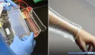 Científicos crean un gel bioimpreso en 3D que promete regenerar piel sin cicatrices