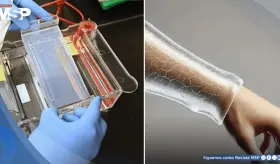 Científicos crean un gel bioimpreso en 3D que promete regenerar piel sin cicatrices