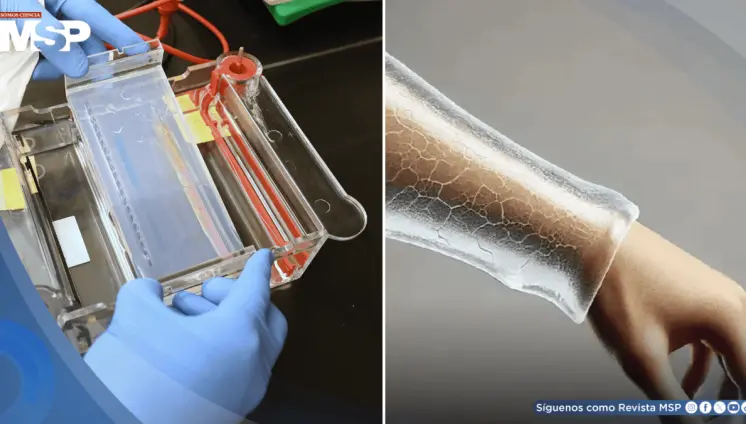Científicos crean un gel bioimpreso en 3D que promete regenerar piel sin cicatrices