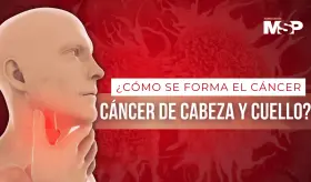 ¿Cómo se forma el cáncer de cabeza y cuello?