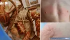 Nueva guía sobre la alergia al pan: causas, síntomas, diagnóstico y manejo