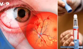 Medicamentos GLP-1 para adelgazar no aumentarían el riesgo de problemas oculares graves: Estudio