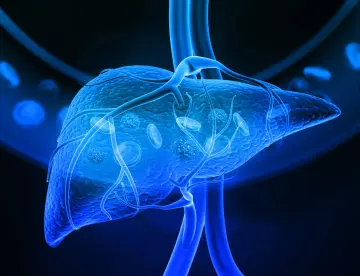 Mini-examen clínico: Evalúe sus conocimientos sobre cáncer de hígado