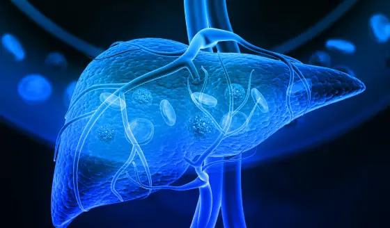 Mini-examen clínico: Evalúe sus conocimientos sobre cáncer de hígado