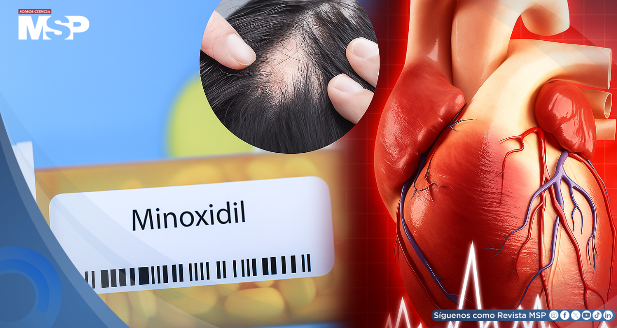 El minoxidil oral a dosis bajas demuestra ser seguro para el corazón en el tratamiento de la alopecia
