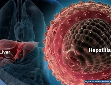 ¿Fatiga constante, dolor abdominal o piel amarillenta? Podrían ser síntomas de hepatitis autoinmune