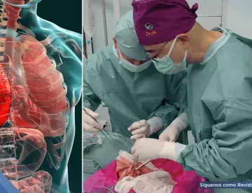 Logran el primer trasplante de pulmón de cerdo modificado genéticamente a un humano 
