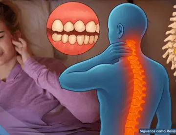 ¿Aprietas los dientes sin darte cuenta? El bruxismo afectaría tu cuello, espalda, abdomen y postura