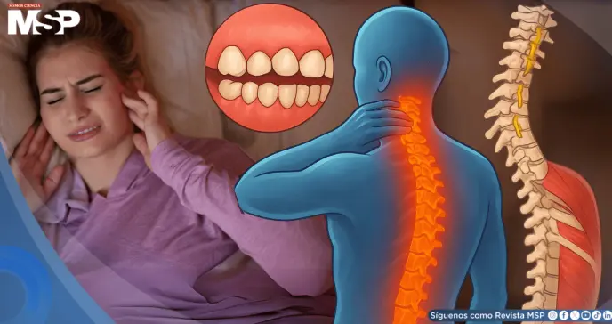 ¿Aprietas los dientes sin darte cuenta? El bruxismo afectaría tu cuello, espalda, abdomen y postura