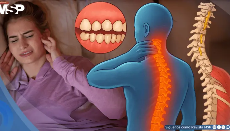 ¿Aprietas los dientes sin darte cuenta? El bruxismo afectaría tu cuello, espalda, abdomen y postura ¿Aprietas los dientes sin darte cuenta? El bruxismo afectaría tu cuello, espalda, abdomen y postura