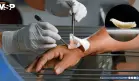 Detectan en EE. UU. el primer caso humano del gusano ´come carne´: Una infestación poco común en personas