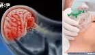 ¿Hipoxia o anoxia? Así reacciona tu cuerpo ante la falta de oxígeno