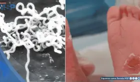 Sífilis congénita: síntomas, diagnóstico y tratamiento para evitar la transmisión de madre a hijo