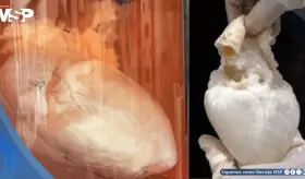Órganos fantasma: Así funciona la bioingeniería que busca acabar con la lista de espera de trasplantes