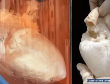 Órganos fantasma: Así funciona la bioingeniería que busca acabar con la lista de espera de trasplantes