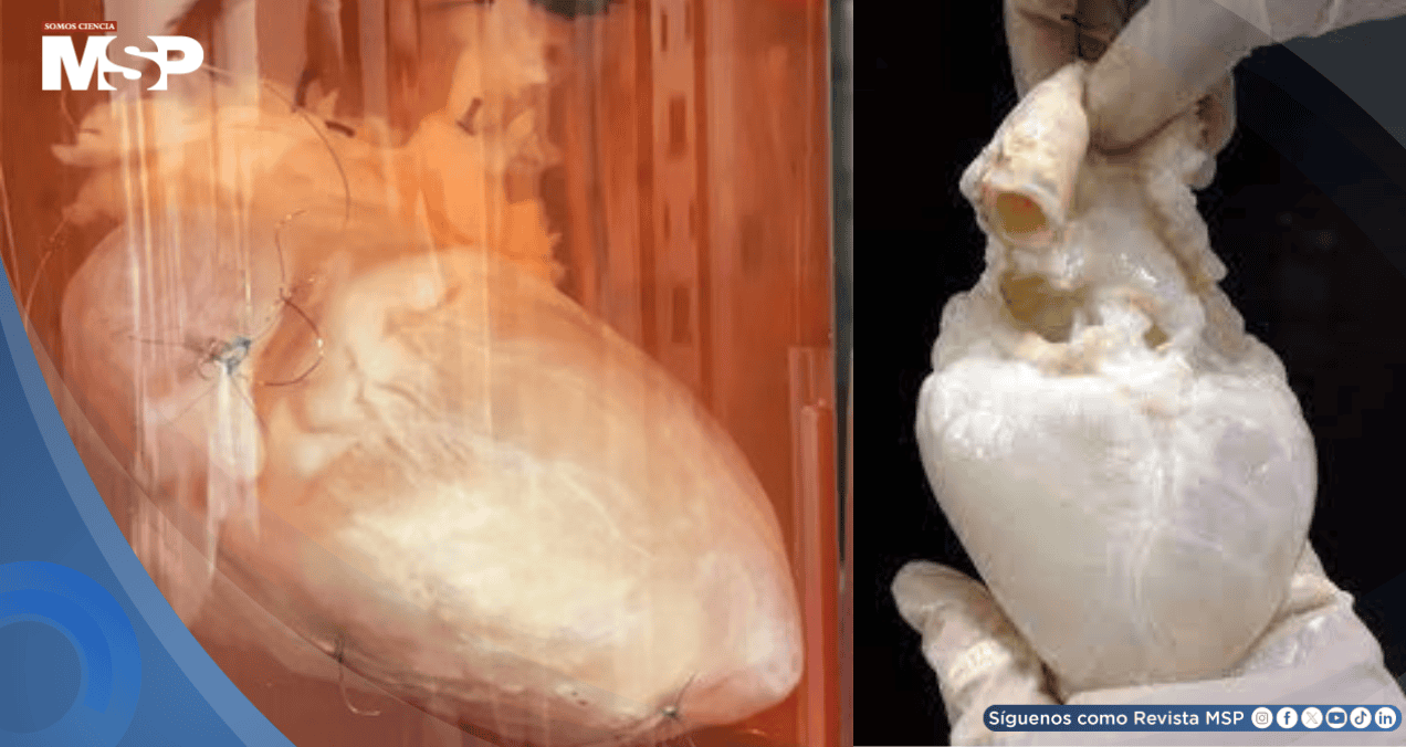 Órganos fantasma: Así funciona la bioingeniería que busca acabar con la lista de espera de trasplantes