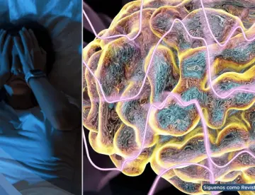 ¿Escucha estallidos o disparos al dormir? Podría ser el síndrome de cabeza explosiva