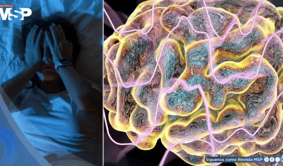 ¿Escucha estallidos o disparos al dormir? Podría ser el síndrome de cabeza explosiva