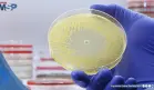 Inteligencia artificial generativa abre camino a nuevos antibióticos contra la resistencia bacteriana