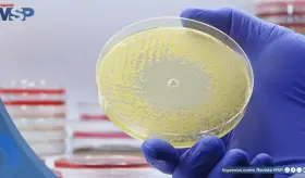 Inteligencia artificial generativa abre camino a nuevos antibióticos contra la resistencia bacteriana