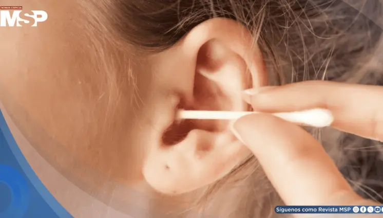 ¿Limpia sus oídos con hisopos? Por qué esto podría afectar sus oídos y cómo limpiarlos correctamente ¿Limpia sus oídos con hisopos? Por qué esto podría afectar sus oídos y cómo limpiarlos correctamente
