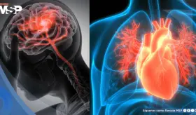 Científicos revelan por qué mujeres aparentemente sanas enfrentan alto riesgo de infarto y ACV