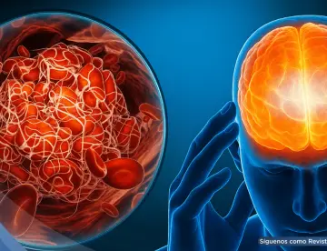Estrés crónico elevaría la glucosa y podría favorecer la diabetes tipo 2 mediante circuito cerebral