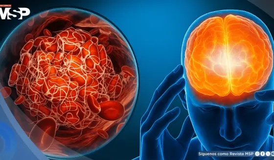 Estrés crónico elevaría la glucosa y podría favorecer la diabetes tipo 2 mediante circuito cerebral
