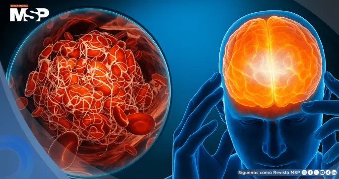 Estrés crónico elevaría la glucosa y podría favorecer la diabetes tipo 2 mediante circuito cerebral