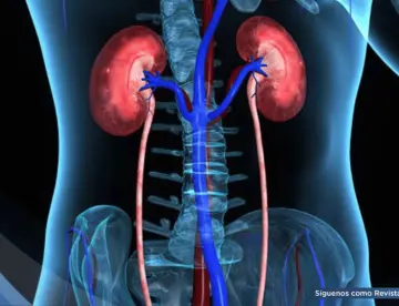 Reportan aumento de 48% de mortalidad por enfermedad renal hipertensiva  en los últimos 25 años