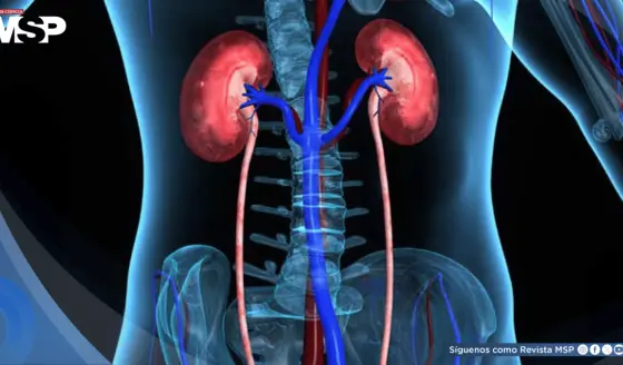 Reportan aumento de 48% de mortalidad por enfermedad renal hipertensiva  en los últimos 25 años