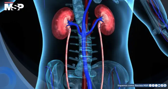 Reportan aumento de 48% de mortalidad por enfermedad renal hipertensiva  en los últimos 25 años