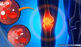 La diabetes estaría relacionada con el dolor de rodilla: ¿Qué hacer y cómo aliviar la molestia?