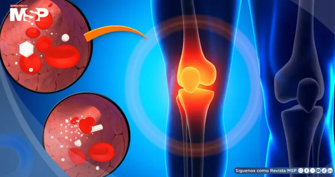 La diabetes estaría relacionada con el dolor de rodilla: ¿Qué hacer y cómo aliviar la molestia?