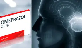 Déficit de magnesio asociado al consumo prolongado de Omeprazol podría desencadenar síndrome cerebeloso