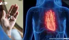 Betabloqueantes tras un infarto podrían no beneficiar a todos y aumentan el riesgo en mujeres: Estudio