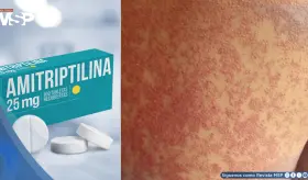 Reacciones cutáneas graves asociado al uso de amitriptilina: Todo lo que debe saber sobre este fármaco